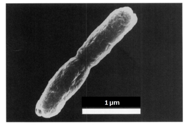 UCDI® Hydrogen bacterium