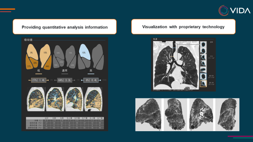 Product Post-Analysis Image